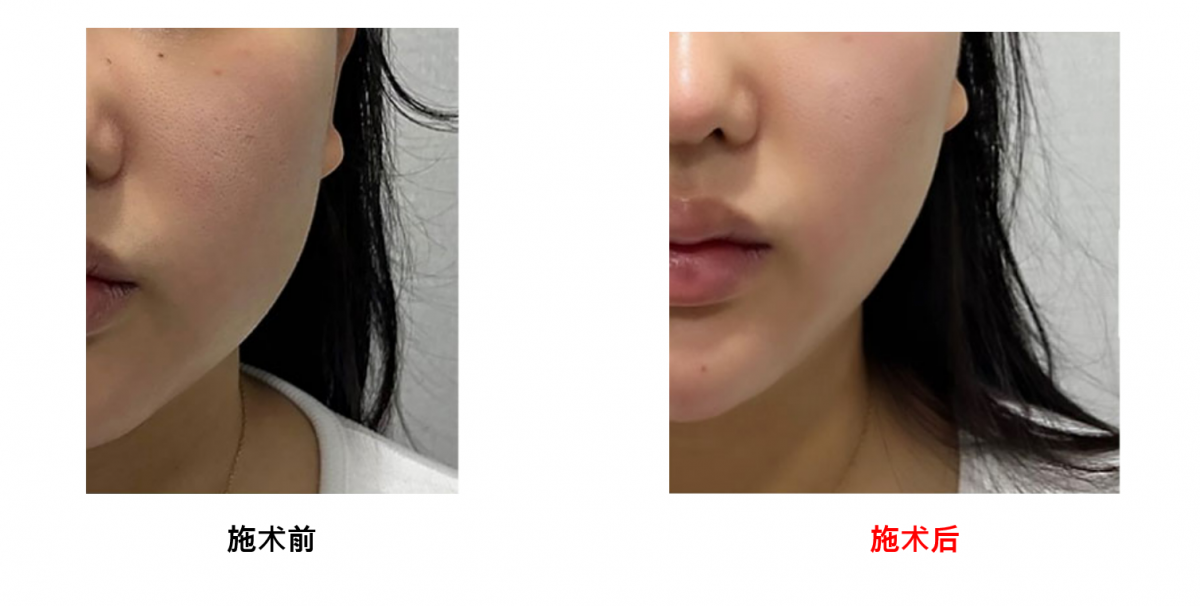 8554729a709b6e40d9e04c6c446794d6_1723184220_4577.png