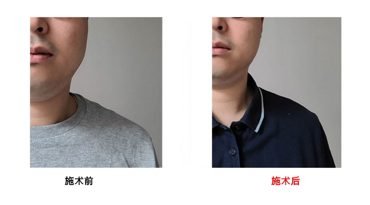8554729a709b6e40d9e04c6c446794d6_1723188114_8906.png